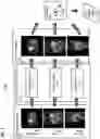 Fig. 05 - Apparatus and method for medical image reconstruction using deep learning to improve image quality in positron emission tomography (PET)