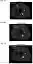 Fig. 09 - Apparatus and method for medical image reconstruction using deep learning to improve image quality in positron emission tomography (PET)