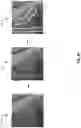 Fig. 04 - Method and apparatus for automatic determination of object and background region of interest for real-time automatic dose rate control in dynamic imaging systems