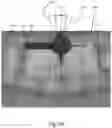 Fig. 05 - METHOD OF DETECTING AN ABNORMALITY ALONG A PORTION OF A DENTAL ARCH