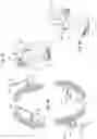 Fig. 06 - METHOD OF DETECTING AN ABNORMALITY ALONG A PORTION OF A DENTAL ARCH