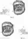 Fig. 04 - Method for scanning material using an ultrasonic imaging probe