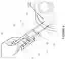 Fig. 07 - Medical device for concurrent collection of multiple tissue samples