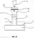 Fig. 07 - VESSEL CLOSURE DEVICE WITH IMPROVED SAFETY AND TRACT HEMOSTASIS