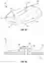 Fig. 16 - VESSEL CLOSURE DEVICE WITH IMPROVED SAFETY AND TRACT HEMOSTASIS