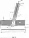 Fig. 26 - VESSEL CLOSURE DEVICE WITH IMPROVED SAFETY AND TRACT HEMOSTASIS