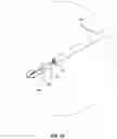 Fig. 40 - VESSEL CLOSURE DEVICE WITH IMPROVED SAFETY AND TRACT HEMOSTASIS