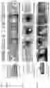 Fig. 07 - BIOADHESIVE MATERIALS AND MINIMALLY INVASIVE METHODS FOR ADHERING TISSUES WITH BIOADHESIVE MATERIALS