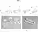 Fig. 08 - BIOADHESIVE MATERIALS AND MINIMALLY INVASIVE METHODS FOR ADHERING TISSUES WITH BIOADHESIVE MATERIALS