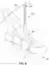 Fig. 08 - Dual-motion rotation and retraction system for minimizing muscle damage in spinal surgery