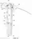 Fig. 11 - Dual-motion rotation and retraction system for minimizing muscle damage in spinal surgery