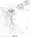 Fig. 15 - Dual-motion rotation and retraction system for minimizing muscle damage in spinal surgery
