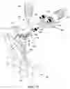 Fig. 17 - Dual-motion rotation and retraction system for minimizing muscle damage in spinal surgery