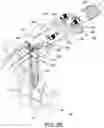 Fig. 20 - Dual-motion rotation and retraction system for minimizing muscle damage in spinal surgery