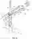 Fig. 24 - Dual-motion rotation and retraction system for minimizing muscle damage in spinal surgery