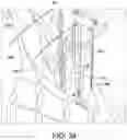 Fig. 33 - Dual-motion rotation and retraction system for minimizing muscle damage in spinal surgery