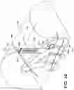 Fig. 47 - Dual-motion rotation and retraction system for minimizing muscle damage in spinal surgery