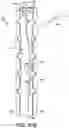 Fig. 49 - Dual-motion rotation and retraction system for minimizing muscle damage in spinal surgery
