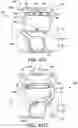 Fig. 53 - Dual-motion rotation and retraction system for minimizing muscle damage in spinal surgery