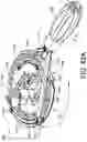 Fig. 55 - Dual-motion rotation and retraction system for minimizing muscle damage in spinal surgery