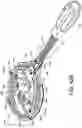 Fig. 56 - Dual-motion rotation and retraction system for minimizing muscle damage in spinal surgery