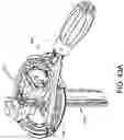Fig. 59 - Dual-motion rotation and retraction system for minimizing muscle damage in spinal surgery