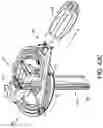Fig. 61 - Dual-motion rotation and retraction system for minimizing muscle damage in spinal surgery