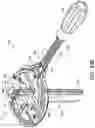 Fig. 63 - Dual-motion rotation and retraction system for minimizing muscle damage in spinal surgery