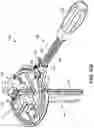 Fig. 64 - Dual-motion rotation and retraction system for minimizing muscle damage in spinal surgery