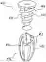 Fig. 01 - EXPANDING IMPLANT AND METHOD OF TISSUE FIXATION