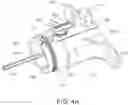 Fig. 05 - Flexible anchor delivery system