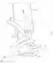 Fig. 04 - Knotting assembly for surgical suture line