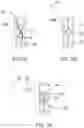Fig. 09 - Devices and Methods for Advancing Knots