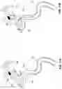 Fig. 12 - Thrombus Aspiration Systems and Related Methods