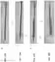 Fig. 17 - Thrombus Aspiration Systems and Related Methods
