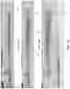 Fig. 18 - Thrombus Aspiration Systems and Related Methods