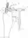 Fig. 01 - FIXING DEVICE FOR A TIBIA ALIGNMENT SYSTEM
