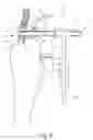 Fig. 03 - FIXING DEVICE FOR A TIBIA ALIGNMENT SYSTEM