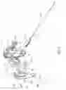 Fig. 03 - DEVICE INCLUDING STEERING CABLES FOR CREATING A CAVITY OR A CHANNEL IN BONE