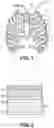 Fig. 02 - INTRAOSSEOUS ACCESS DEVICE AND LOCATOR ASSEMBLY