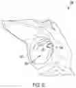 Fig. 08 - Devices and systems for nail-based bone fixation