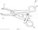 Fig. 11 - Devices and systems for nail-based bone fixation