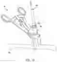 Fig. 16 - Devices and systems for nail-based bone fixation