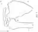 Fig. 02 - Guides and instruments for improving accuracy of glenoid implant placement