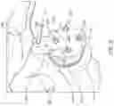 Fig. 11 - Guides and instruments for improving accuracy of glenoid implant placement