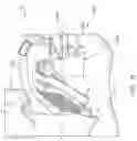 Fig. 19 - Guides and instruments for improving accuracy of glenoid implant placement