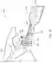 Fig. 23 - Guides and instruments for improving accuracy of glenoid implant placement
