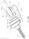 Fig. 29 - Guides and instruments for improving accuracy of glenoid implant placement