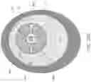 Fig. 53 - Guides and instruments for improving accuracy of glenoid implant placement