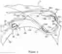 Fig. 04 - A CLAMP AND CABLE